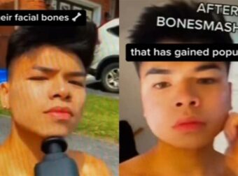 «Μην σπάτε σκόπιμα τα οστά στο πρόσωπό σας»: Πώς το «bone smashing» επηρεάζει τα νεαρά αγόρια στο TikTok