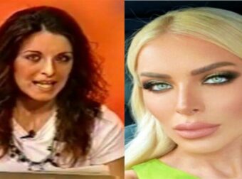 «Πως έγινες έτσι, έλεος δεν αναγνωρίζεσαι»: Η παραμόρφωση της Κατερίνας Καινούργιου μετά την αποτυχημένη πλαστική επέμβαση