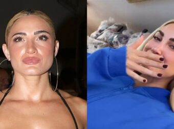 Ιωάννα Τούνη – Σοκάρει η εικόνα μετά την επέμβαση στα χείλη: «Φαίνομαι σαν πάπια»