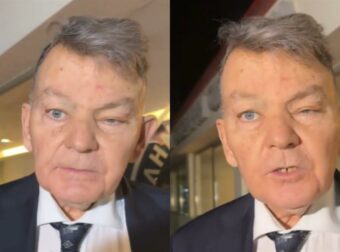 Αλέξης Κούγιας: Η πορεία της υγείας του από το 2021, όταν διαγνώστηκε με καρκίνο.