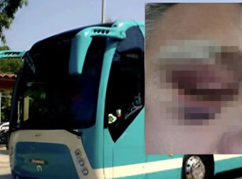 Νέα Άγρια επίθεση σε οδηγό ΚΤΕΛ: Τον χτύπησαν στο κεφάλι με κράνη (video)