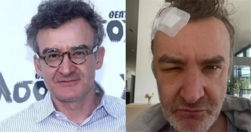 Νίκος Ορφανός: «Είχα όγκο στο κεφάλι» – Τι είναι το κρανιοφαρυγγίωμα για το οποίο έκανε επέμβαση στη Γερμανία