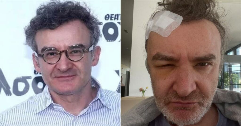 Νίκος Ορφανός: «Είχα όγκο στο κεφάλι» – Τι είναι το κρανιοφαρυγγίωμα για το οποίο έκανε επέμβαση στη Γερμανία