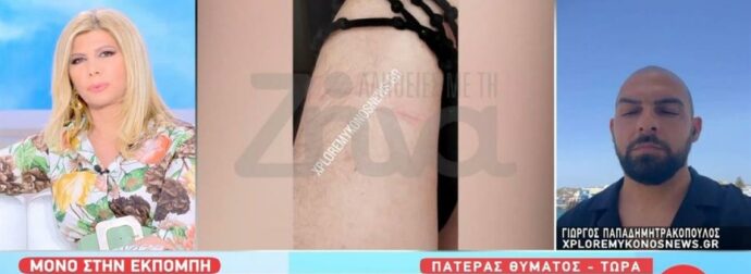 Καταγγελία σοκ στη Μύκονο: Διαβητικός ξυλοκοπήθηκε από αστυνομικούς – Τον πέρασαν για χρήστη ναρκωτικών