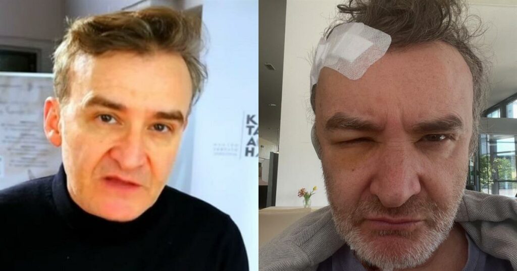 Νίκος Ορφανός: Χειρουργείο για όγκο στον εγκέφαλο για τον γνωστό ηθοποιό – Η περιπέτεια που κανείς δε γνώριζε