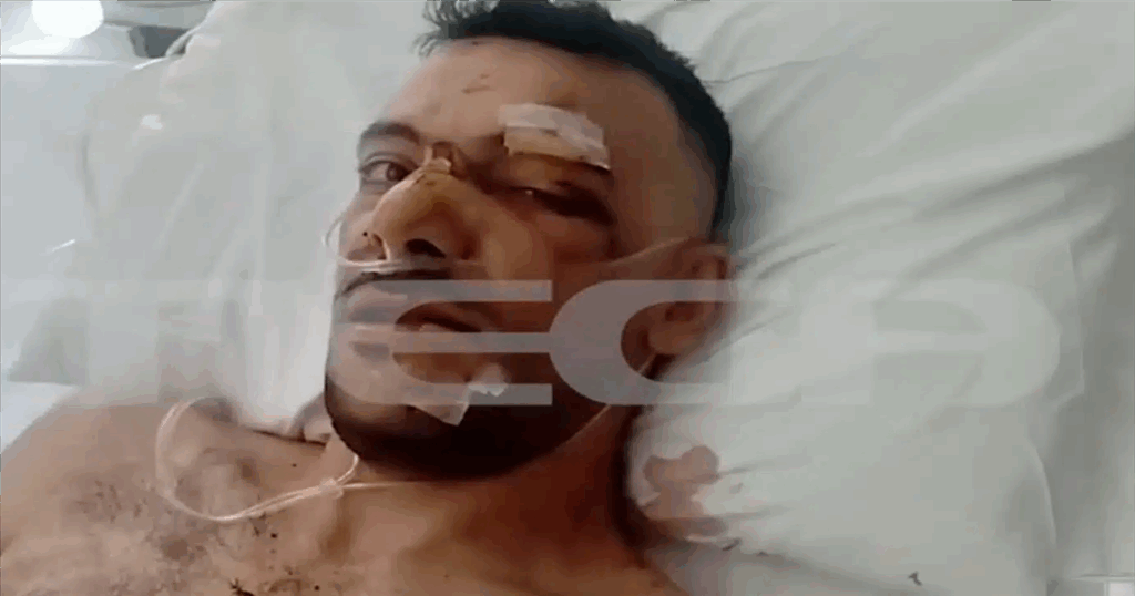 «Έχει τρύπες σε πνεύμονα, διάφραγμα και του κόπηκαν οι μύες»: Από θαύμα ζει ο 35χρονος που δέχθηκε 18 μαχαιριές σε πανηγύρι