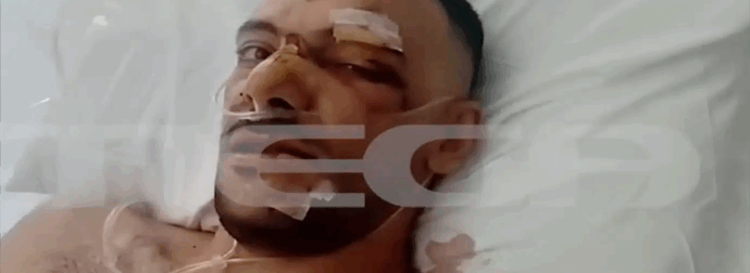 «Έχει τρύπες σε πνεύμονα, διάφραγμα και του κόπηκαν οι μύες»: Από θαύμα ζει ο 35χρονος που δέχθηκε 18 μαχαιριές σε πανηγύρι