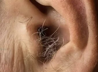 Το γνωρίζατε; Αν φυτρώνουν τρίχες στα αυτιά σας, αυτό συμβαίνει επειδή το σώμα σας…