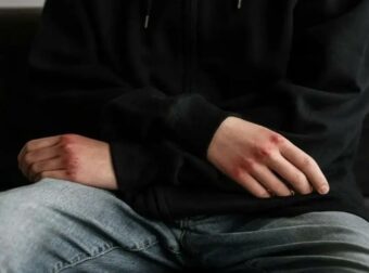 Έκτακτη Είδηση Τώρα με 15χρονο και 16χρονο που Σοκάρει την Ελλάδα