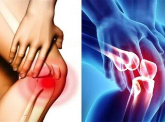 Σας πονάνε τα γόνατα; Οι επιστήμονες… μίλησαν αυτά είναι τα καλύτερα παπούτσια για όσους έχουν πρόβλημα και ποια απαγορεύονται αυστηρά