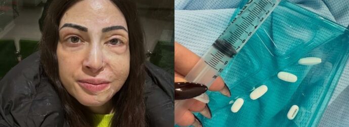 Παλιοσπύρου: Φωτογραφίες & βίντεο από τον δύσκολο αγώνα της αποθεραπείας – «Με ρωτάς πως αντέχω…»