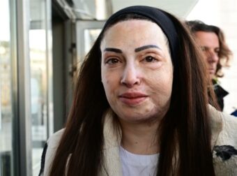 Ιωάννα Παλιοσπύρου: Η συγκλονιστική ανάρτηση για τα σημάδια της επίθεσης με βιτριόλι – «Με ρωτάς πώς αντέχω…»