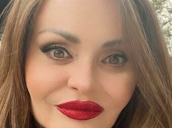 Παραμορφώθηκε από την πλαστικές, μοιάζει ψεύτικη: Την θυμάστε; 26 χρόνια μετά, δεν την αναγνωρίζει κανείς