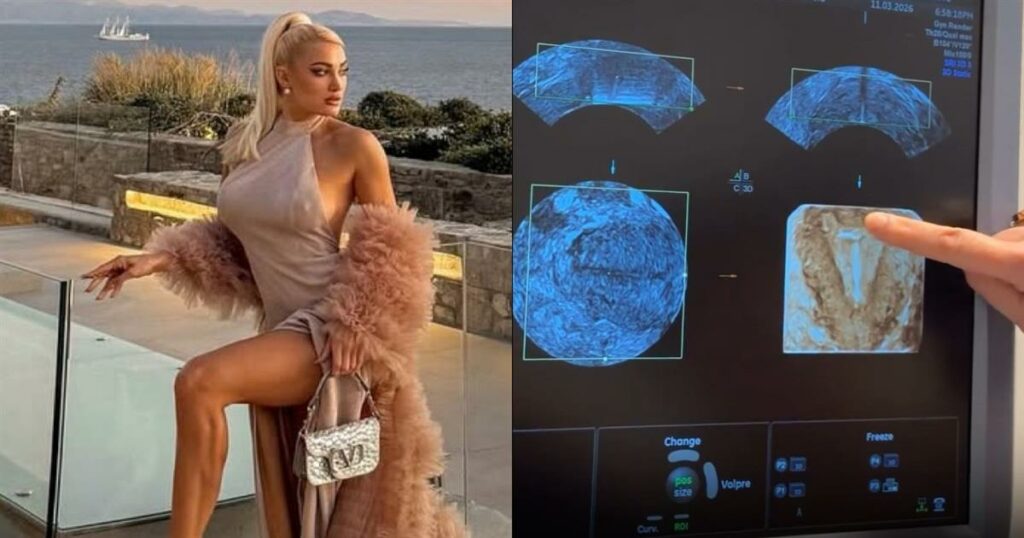 Ιωάννα Τούνη: Έδειξε τον υπέρηχο και έγινε χαμός – Πώς απάντησε στις φήμες εγκυμοσύνης