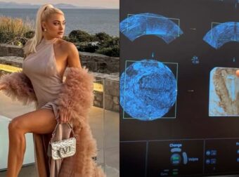 Ιωάννα Τούνη: Έδειξε τον υπέρηχο και έγινε χαμός – Πώς απάντησε στις φήμες εγκυμοσύνης