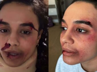 Πηνελόπη Πλάκα: «Πήρα έτσι τη μαμά μου, το ξέρω ήτανε χοντρό»