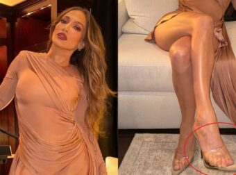 Τζένιφερ Λόπεζ: Σάλος με φωτογραφία που ανέβασε – Φαίνεται να έχει 6 δάχτυλα στα πόδια!