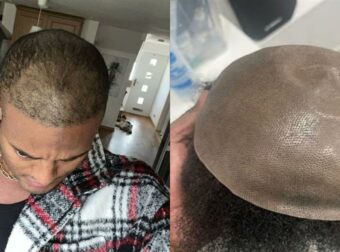 Ο «Mr Tinder» αποκαλύπτει το μεγάλο του μυστικό: Φορούσα περούκες επί 14 χρόνια για να κρύψω την αλήθεια