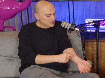 Θανάσης Αλευράς για τη ψωρίαση: «Δεν σταμάτησα ποτέ να την παρατηρώ, έλεγα “εγώ γιατί να το βγάλω;”»