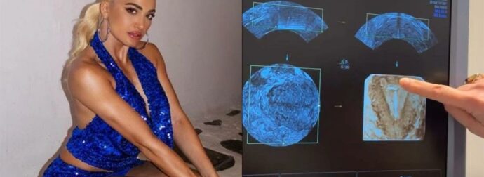 Η Ιωάννα Τούνη το τερμάτισε: Πήρε τους φίλους της στα social ακόμη και στην γυναικολόγο για να αποκαλύψει ότι έχει βάλει σπιράλ