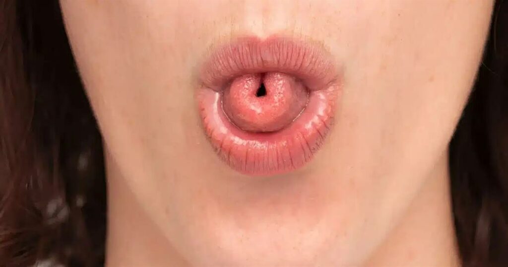 Τι σημαίνει ψυχολογικά η ικανότητα να διπλώνεις τη γλώσσα σου σε σχήμα «U»