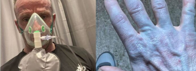 Ξύπνησε και ήταν όλος μπλε: Όταν πήγε στο νοσοκομείο οι γιατροί έκλαψαν από τα γέλια