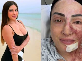 Ιωάννα Παλιοσπύρου: Συγκλονίζει η ανάρτηση για τις νέες θεραπείες της στην Αγγλία