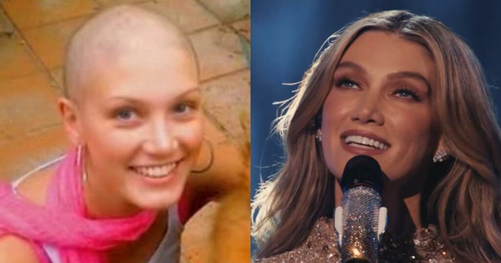 Delta Goodrem: Τι είναι το λέμφωμα Hodgkin που «χτύπησε» την εκπρόσωπο της Αυστραλίας στα 18 της – Ο γάμος υπερπαραγωγή το 2025 στην Μάλτα (Φωτογραφίες)