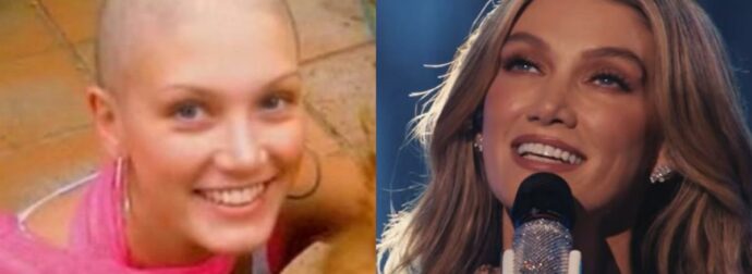 Delta Goodrem: Τι είναι το λέμφωμα Hodgkin που «χτύπησε» την εκπρόσωπο της Αυστραλίας στα 18 της – Ο γάμος υπερπαραγωγή το 2025 στην Μάλτα (Φωτογραφίες)