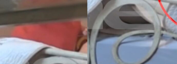 Χίος – «Μην με χτυπάς, δεν έκανα τίποτα»: Η κόλαση που έζησε 84χρονη με άνοια από την «φροντίστρια» της – Βίντεο ντοκουμέντο