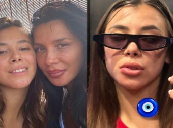 «Σαν αποτυχημένο υαλουρονικό!»: Η κόρη της Πάολα παραμορφώθηκε – Τι συνέβη (Βίντεο)