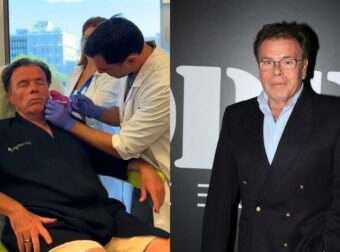 Ο Δημήτρης Παπανώτας στον αισθητικό του – Το βίντεο από την ώρα της θεραπείας στο πρόσωπό του (Βίντεο)