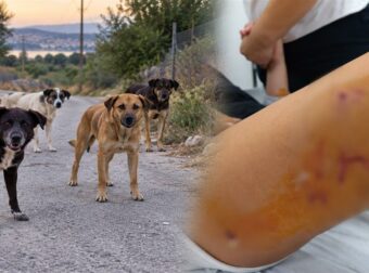 Αγέλη αδέσποτων σκυλιών επιτέθηκε και τραυμάτισε 12χρονη – «Είναι σοκαρισμένη, δεν έχει ηρεμήσει», λέει ο πατέρας της