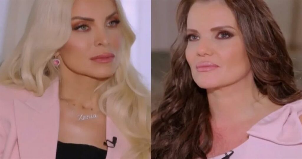 Κιμ Κίλιαν: «Τσακισμένη» στο Super Κατερίνα μετά την περιπέτεια με τον καρκίνο – «Το να σου ξυρίζουν το κεφάλι δεν το ξεχνάς ποτέ»